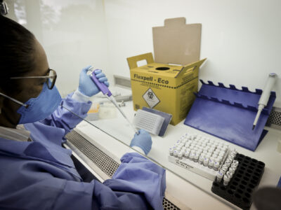 DF registra 29 casos importados de malária em 2025