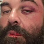 Homem é agredido ao reclamar de som alto em igreja no litoral de SC