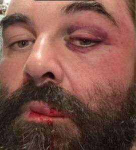Homem é agredido ao reclamar de som alto em igreja no litoral de SC